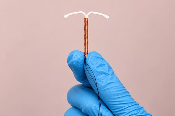 Foto - DIU (Dispositivo Intrauterino)